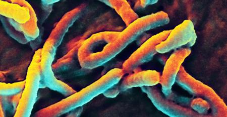 Aid links: Ebola strikes, donations drop, and Gates debates
